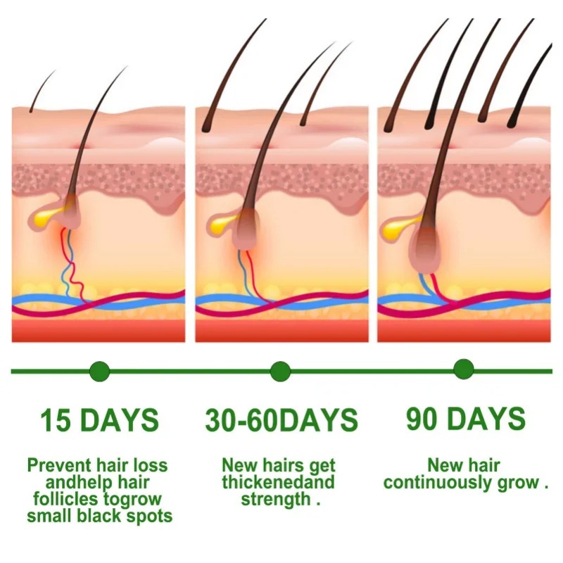 Hair Growth Serum Fast Growing - Beard Oil Growth ulasan dan harga